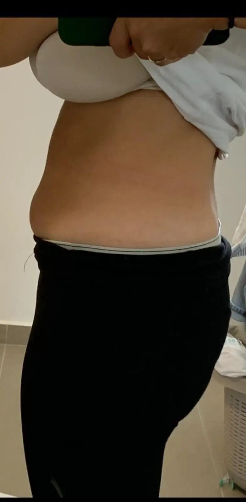 image-after